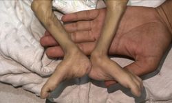 İsrail'in kıtlığı dayattığı Gazze'de son 24 saatte 2'si çocuk 6 Filistinli açlıktan hayatını kaybetti
