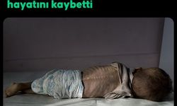 Gazze’de Yetersiz Beslenme Nedeniyle Bir Çocuk Daha Hayatını Kaybetti