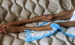 İsrail'in kıtlığı dayattığı Gazze'de son 24 saatte 2'si çocuk 6 kişi daha açlıktan hayatını kaybetti