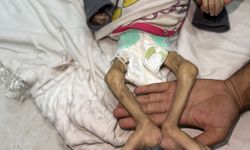 Cumhurbaşkanı Erdoğan, İsrail'in Gazze'deki soykırımını AA'nın fotoğraflarıyla dünyaya anlattı