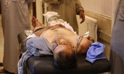 Suriye'nin Halep kentinde, PKK/YPG ile Suriye güvenlik güçleri arasında çatışma çıktı
