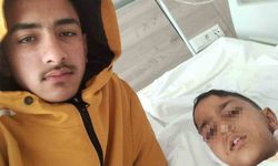 Ankara'da sokak köpeğinin saldırısına uğrayan çocuk yaralandı