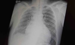 Profesör açıkladı: 'Metamfetamin ve kokain gençler arasında tehlikeli boyutlara ulaştı'