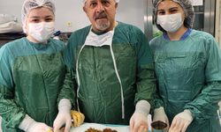 Karın ağrısıyla gitti, safrasından binlerce taş çıktı