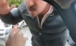 Ailesinin yanında saldırıya uğradı: Olayın faturası 430 bin lira oldu