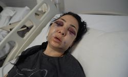 Oğlunun gözü önünde anneyi öldüresiye dövdüler: ''Küfür etmeyin' dedik diye bu hale geldim'