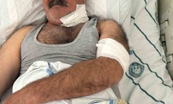 At sahibini boğazından ısırarak ağır yaraladı