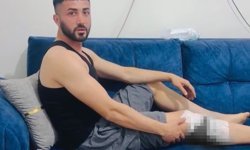 Nizip'te başıboş köpek saldırısında yaralanan 2 kişi belediyeye tepki gösterdi