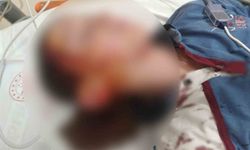 Köpek saldırısında yaralanan çocuk için 1 milyon 200 bin tazminat