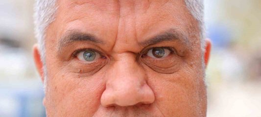 Kahramanmaraşlı adam 3 renkli gözleriyle görenlerin ilgisini çekiyor