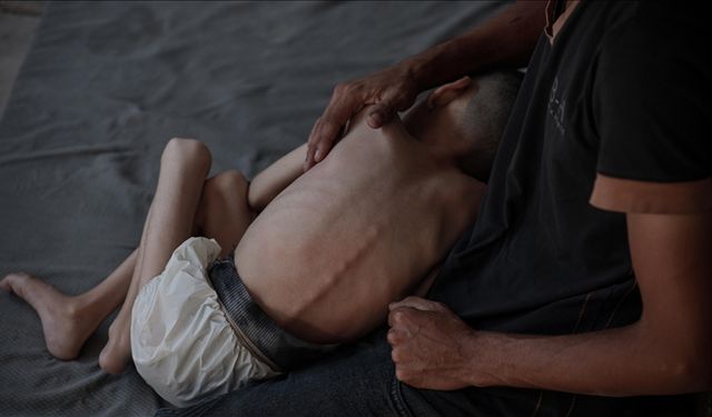 İsrail'in kıtlığı dayattığı Gazze'de son 24 saatte biri çocuk 7 kişi açlıktan hayatını kaybetti