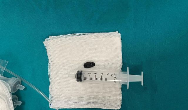 Batman'da akciğerinden çekirdek kabuğu çıkarılan 15 aylık bebek sağlığına kavuştu