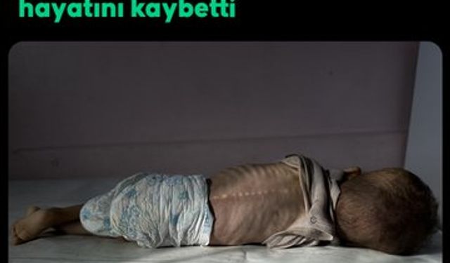 Gazze’de Yetersiz Beslenme Nedeniyle Bir Çocuk Daha Hayatını Kaybetti