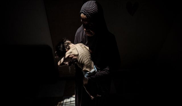İsrail'in kıtlığı dayattığı Gazze'de son 24 saatte 5 kişi daha açlıktan hayatını kaybetti