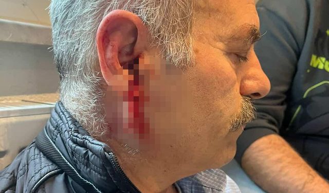 Silivri'de özel bakım merkezine çağrılan eski çalışan darbedildi