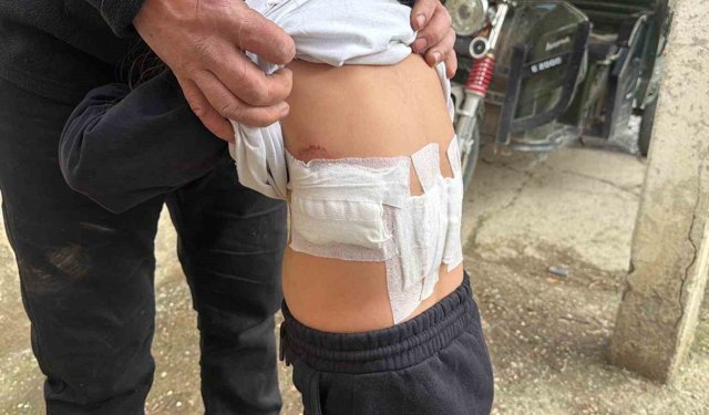 Saldırgan eşek evinin önünde oynayan 5 yaşındaki çocuğa kabusu yaşattı