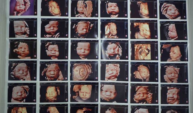 7 yıllık bebek hasreti 'kişiye özel' tedaviyle son buldu