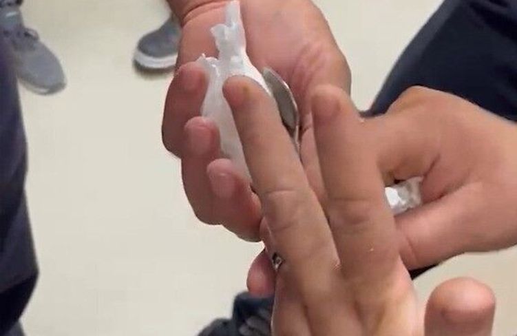 Yüzüğü parmağına sıkışan kadının yardımına itfaiye koştu