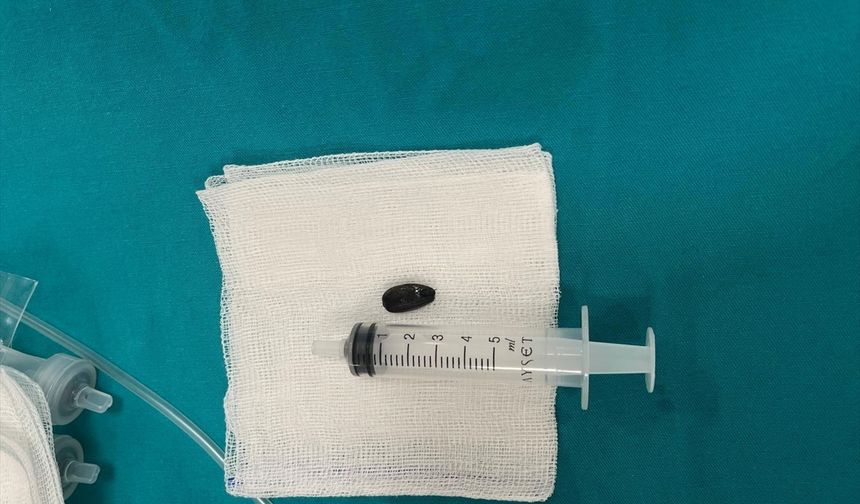Batman'da akciğerinden çekirdek kabuğu çıkarılan 15 aylık bebek sağlığına kavuştu
