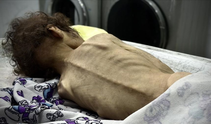 Açlıkla boğuşan Gazze Şeridi'nde son 24 saatte 2’si çocuk 4 kişi daha açlıktan hayatını kaybetti