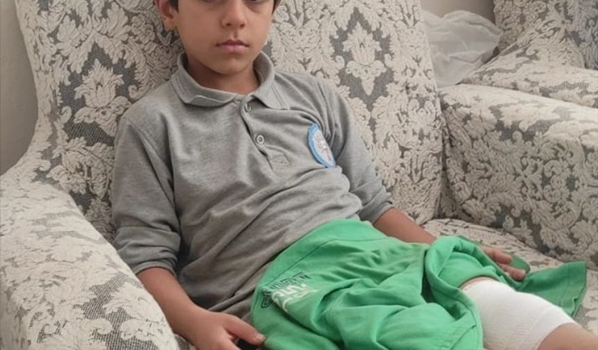 Bursa'da sahipsiz köpeğin saldırdığı çocuk bacağından yaralandı