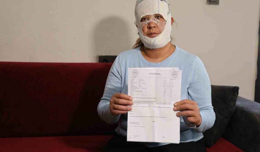 Güzelleşmek uğruna gittiği merkezde yüzü yandı