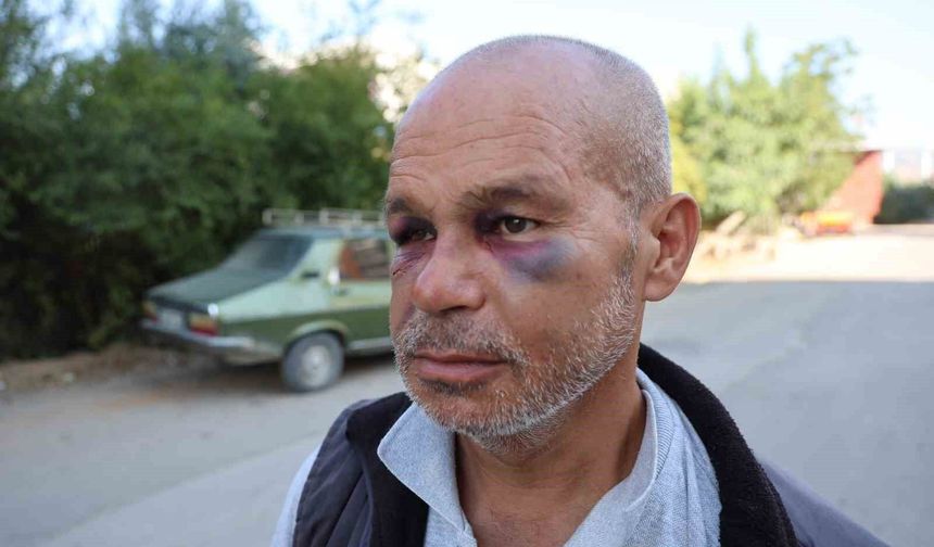 Duyma ve konuşma engelli adamı darp ettiler, aile şikayetçi oldu